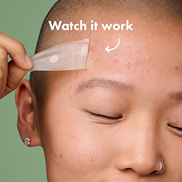 Mighty Patch Surface Large Pimple Patches for Face from Hero Cosmetics, Acne Spot for Body, Cheek, Forehead, and Chin, Pimple Stickers, Hydrocolloid Covers, Vegan-friendly, 10 Count - Image 4